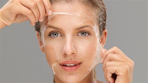 Kimyasal Peeling Nedir ve Nasıl Yapılır?